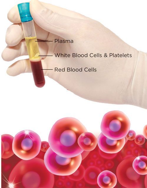 PRP Blood Tube for Hair Treatment