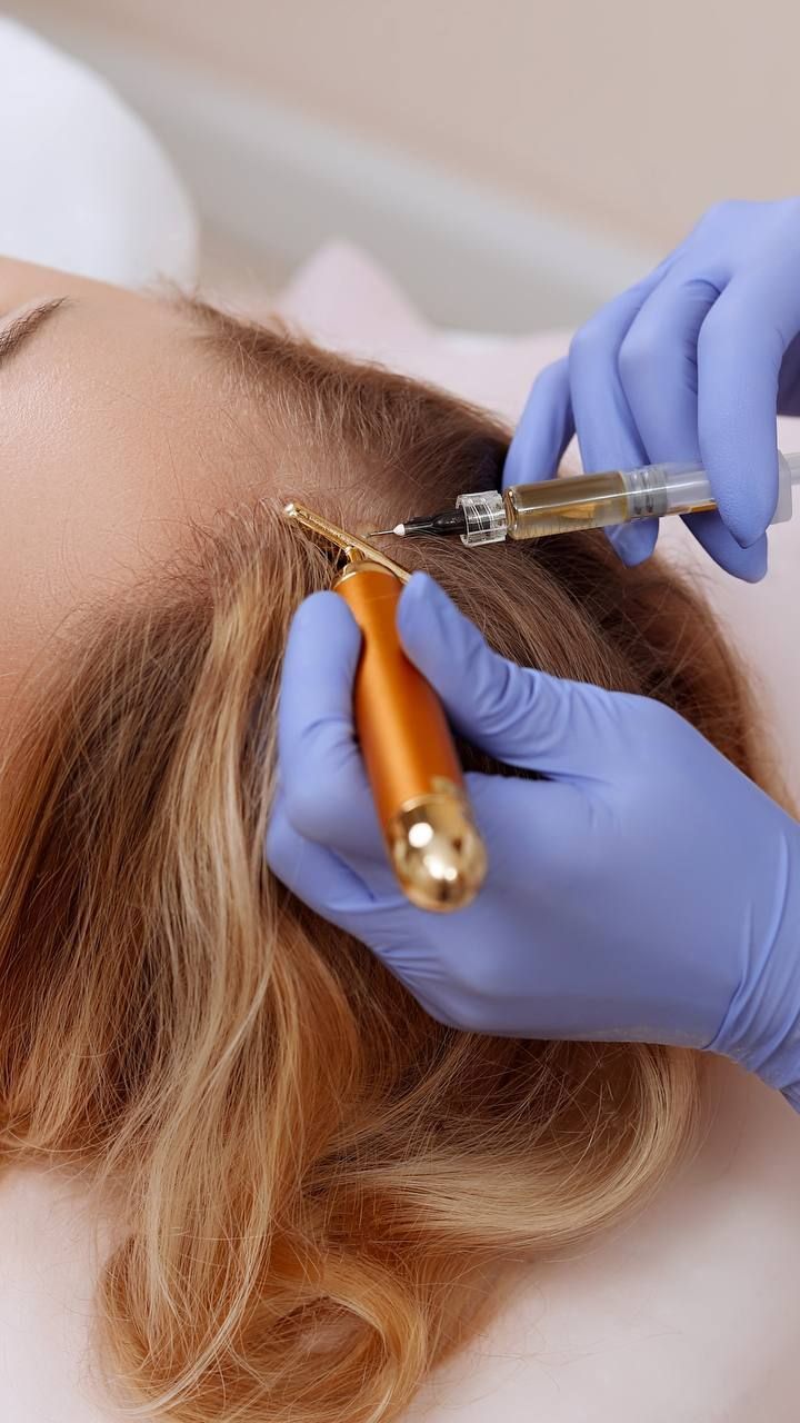 Hair Mesotherapy Treatment