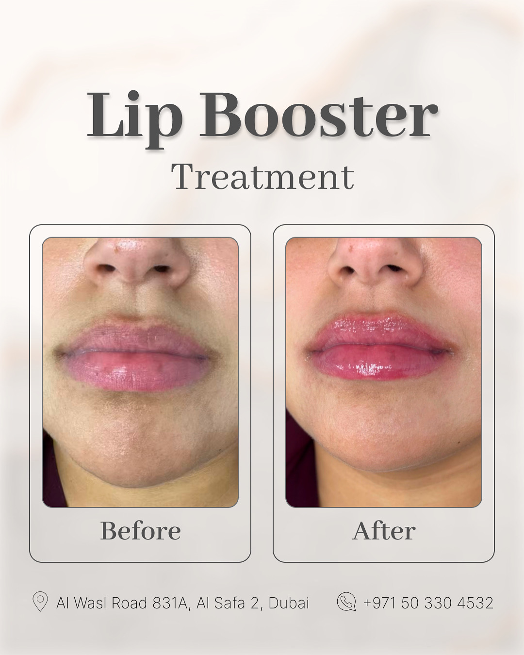 Lip Booster Before & After